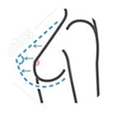 Icono de procedimiento para aumento de senos con el Dr. Rodrigo Montoya en Medellín