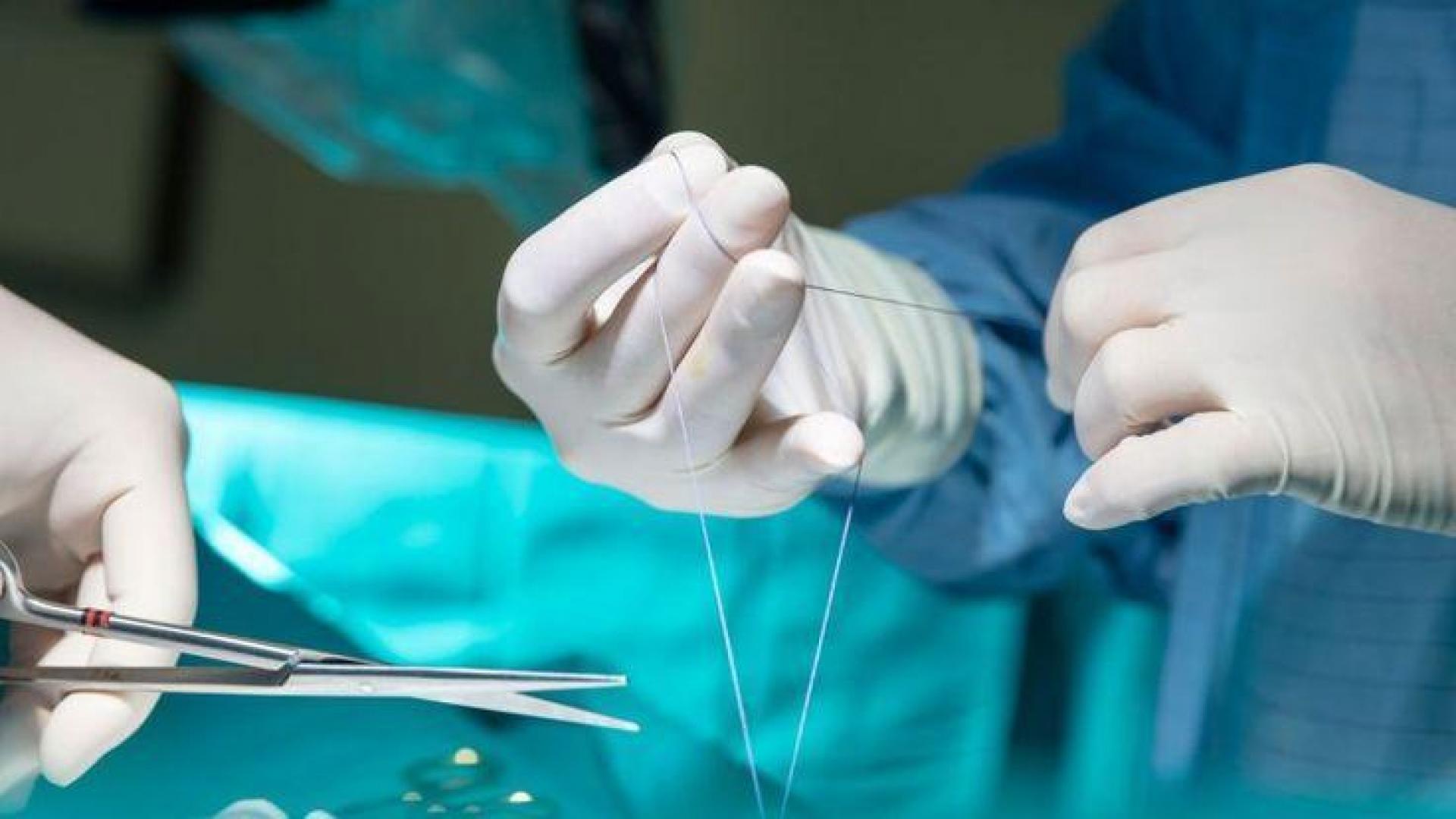 Cierre quirúrgico endonasal en una rinoplastia de técnica cerrada