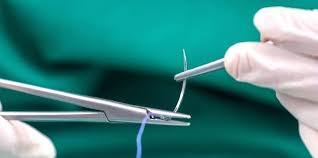 Técnica de sutura multicapa endonasal en rinoplastia cerrada