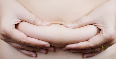 Abdomen antes de una abdominoplastia con el Dr. Rodrigo Montoya en Medellín