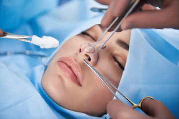 Mujer en quirófano durante una rinoplastia con técnica cerrada